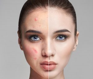 Snep Reinature, la linea specifica per gli inestetismi della pelle